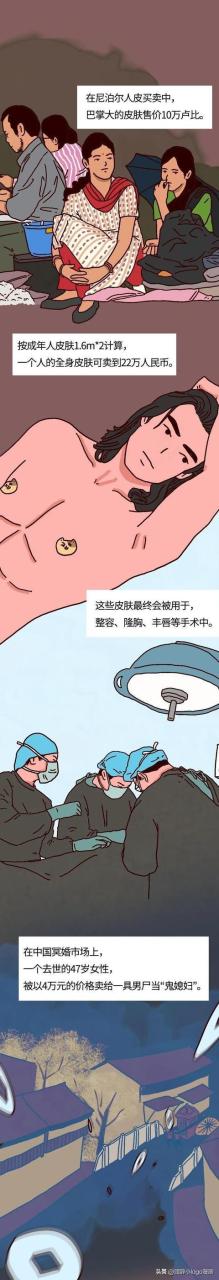 現在—個腎值多少錢插圖2 現在—個腎值多少錢插圖2